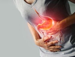 Cara Alami Mengobati Asam Lambung: Solusi Sehat Tanpa Obat Kimia